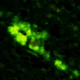 Microscopic image of synthetic human prions accumulating in the brain of a mouse that was genetically altered to produce a certain human protein.